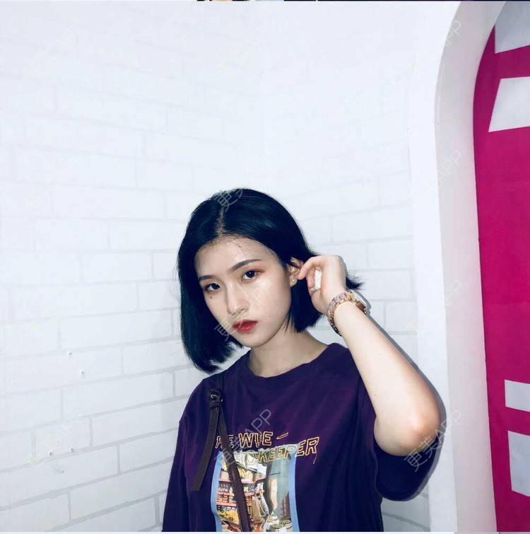 更美 - 罗兰儿的牙齿瓷贴面经验 | 成都 | 牙齿瓷贴面