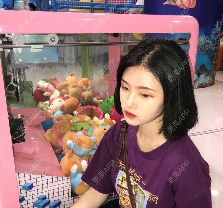 更美 - 罗兰儿的牙齿瓷贴面经验 | 成都 | 牙齿瓷贴面