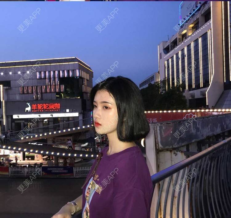 更美 - 罗兰儿的牙齿瓷贴面经验 | 成都 | 牙齿瓷贴面