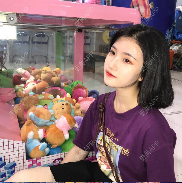 更美 - 罗兰儿的牙齿瓷贴面经验 | 成都 | 牙齿瓷贴面