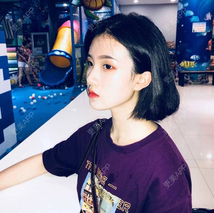 更美 - 罗兰儿的牙齿瓷贴面经验 | 成都 | 牙齿瓷贴面