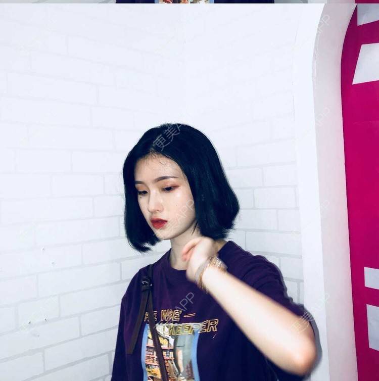 更美 - 罗兰儿的牙齿瓷贴面经验 | 成都 | 牙齿瓷贴面