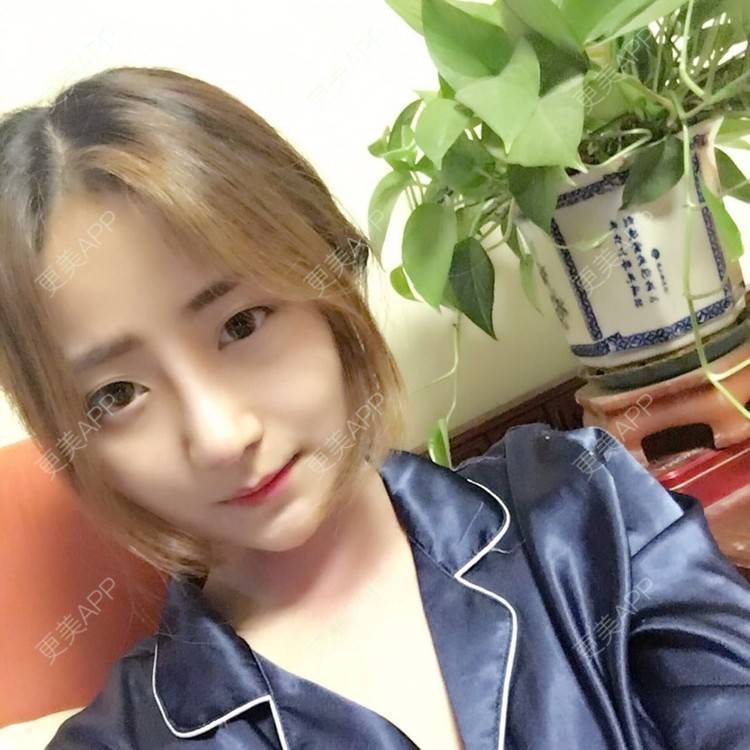 更美 - 更美用户qmLmUIMryz的肋软骨隆鼻经验 | 南阳 | 肋软骨隆鼻