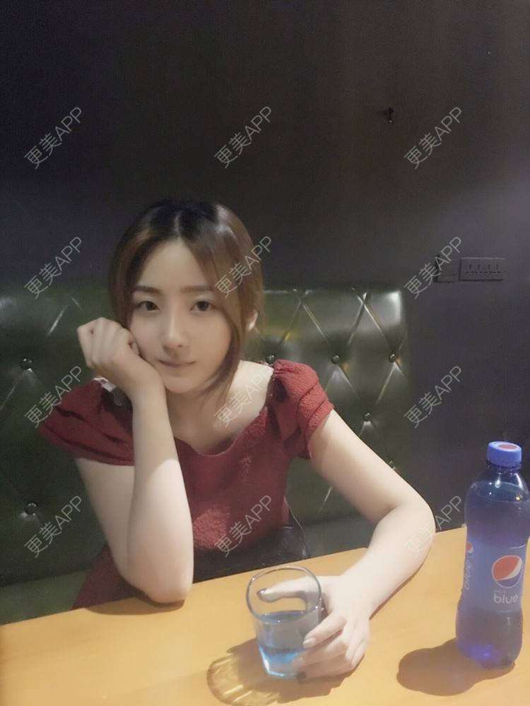 更美 - 更美用户qmLmUIMryz的肋软骨隆鼻经验 | 南阳 | 肋软骨隆鼻