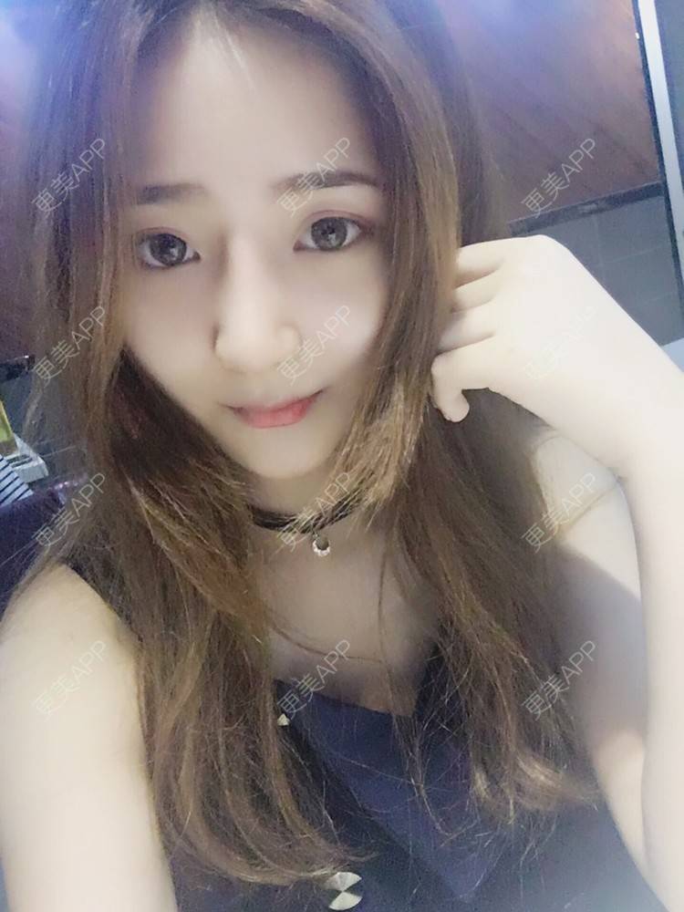 更美 - 更美用户qmLmUIMryz的肋软骨隆鼻经验 | 肋软骨隆鼻 | 南阳