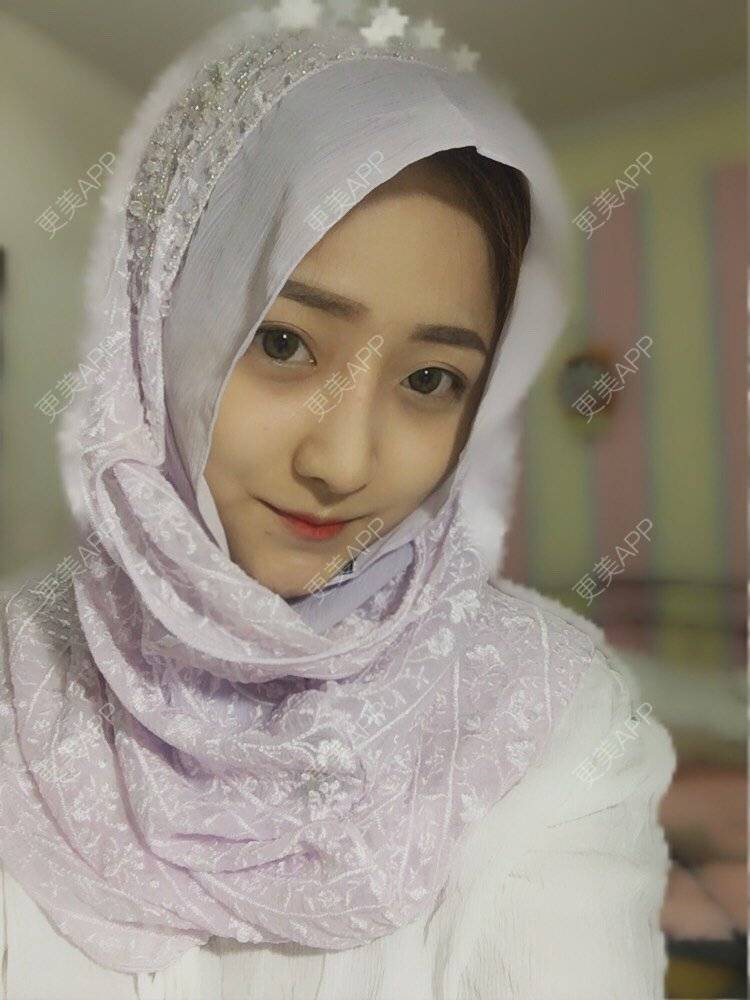 更美 - 更美用户qmLmUIMryz的肋软骨隆鼻经验 | 肋软骨隆鼻 | 南阳