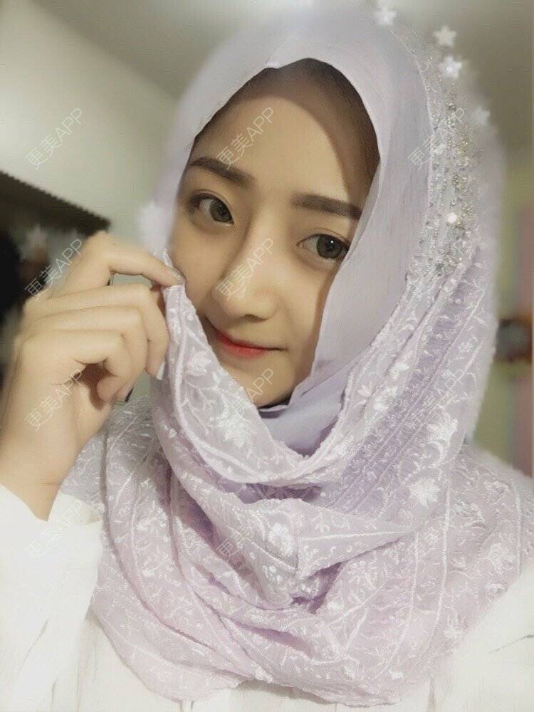 更美 - 更美用户qmLmUIMryz的肋软骨隆鼻经验 | 肋软骨隆鼻 | 南阳