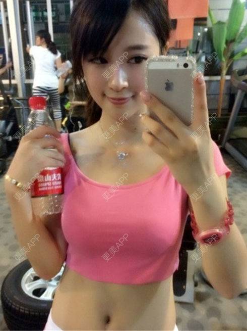 更美 - 酥酥酥的假体隆胸经验 | 假体隆胸 | 南昌