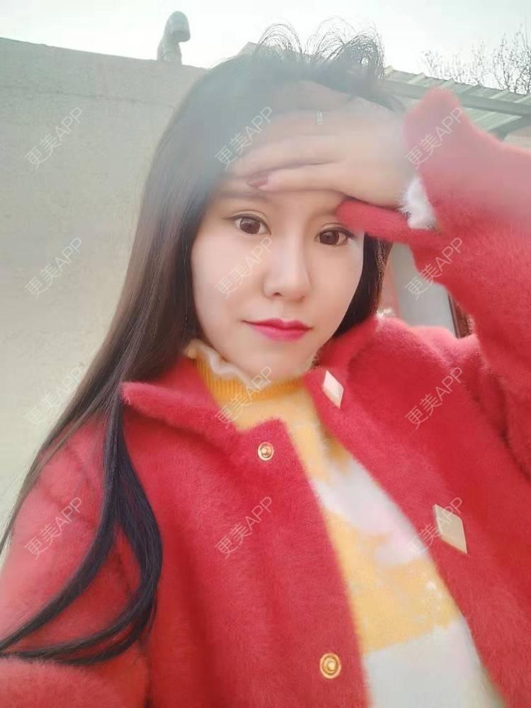 更美 - NOROOTS的吸脂经验 | 自体脂肪隆胸 | 自体脂肪全面部填充 | 自体脂肪填充面部细纹 | 吸脂 | 视频日记 | 自体脂肪垫下巴 | 乳晕缩小 | 自体脂肪身体塑形 | 北京