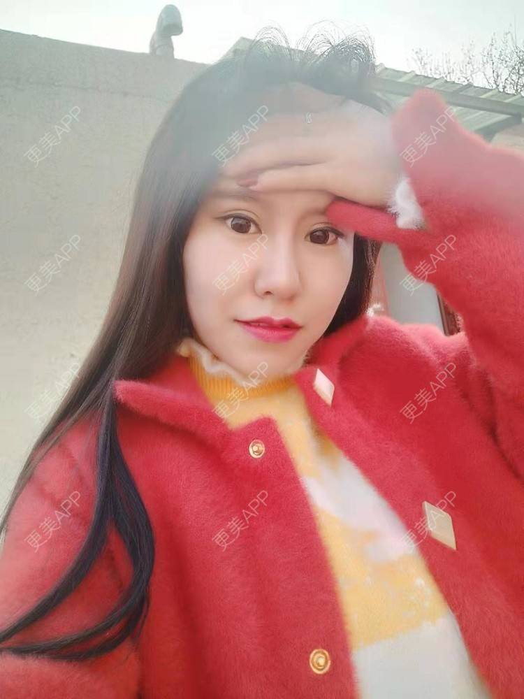 更美 - NOROOTS的吸脂经验 | 自体脂肪隆胸 | 自体脂肪全面部填充 | 自体脂肪填充面部细纹 | 吸脂 | 视频日记 | 自体脂肪垫下巴 | 乳晕缩小 | 自体脂肪身体塑形 | 北京