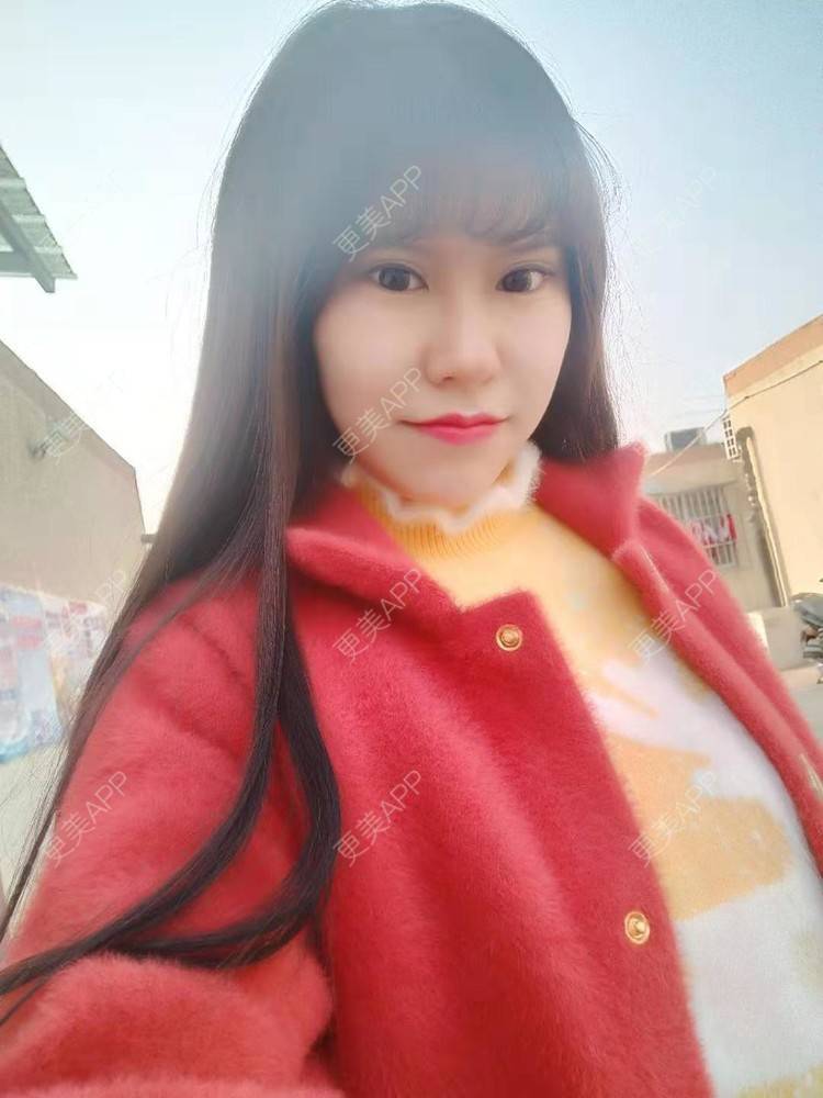 更美 - NOROOTS的吸脂经验 | 自体脂肪隆胸 | 自体脂肪全面部填充 | 自体脂肪填充面部细纹 | 吸脂 | 视频日记 | 自体脂肪垫下巴 | 乳晕缩小 | 自体脂肪身体塑形 | 北京