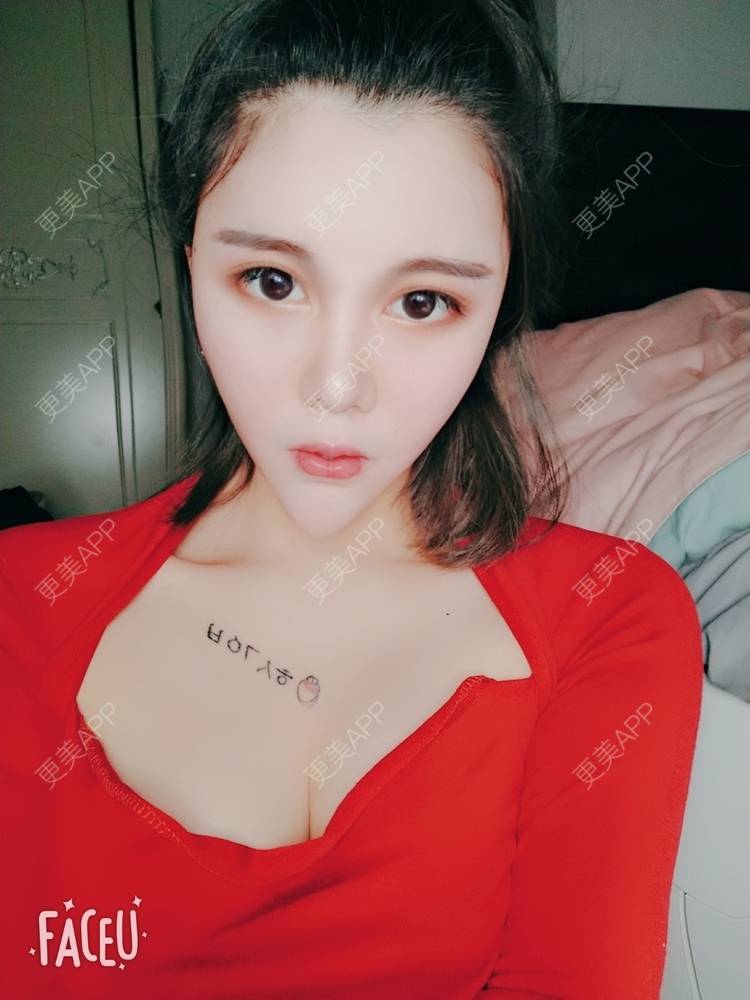 更美 - 美丽的撞身的吸脂经验 | 自体脂肪隆胸 | 自体脂肪全面部填充 | 自体脂肪填充面部细纹 | 自体脂肪丰面颊 | 自体脂肪丰太阳穴 | 视频日记 | 吸脂 | 吸脂瘦脸 | 吸脂瘦大腿 | 自体脂肪身体塑形 | 北京