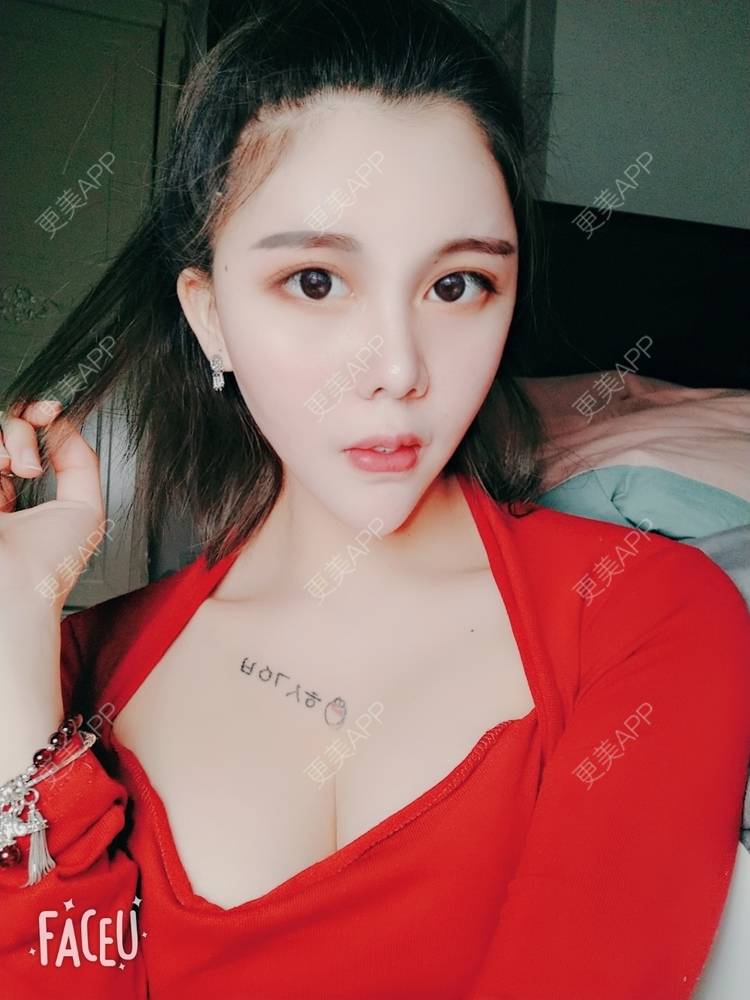 更美 - 美丽的撞身的吸脂经验 | 自体脂肪隆胸 | 自体脂肪全面部填充 | 自体脂肪填充面部细纹 | 自体脂肪丰面颊 | 自体脂肪丰太阳穴 | 视频日记 | 吸脂 | 吸脂瘦脸 | 吸脂瘦大腿 | 自体脂肪身体塑形 | 北京