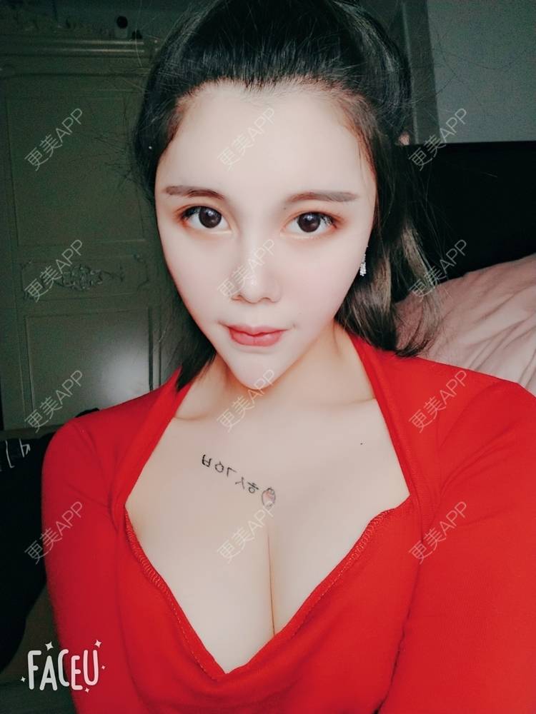 更美 - 美丽的撞身的吸脂经验 | 自体脂肪隆胸 | 自体脂肪全面部填充 | 自体脂肪填充面部细纹 | 自体脂肪丰面颊 | 自体脂肪丰太阳穴 | 视频日记 | 吸脂 | 吸脂瘦脸 | 吸脂瘦大腿 | 自体脂肪身体塑形 | 北京