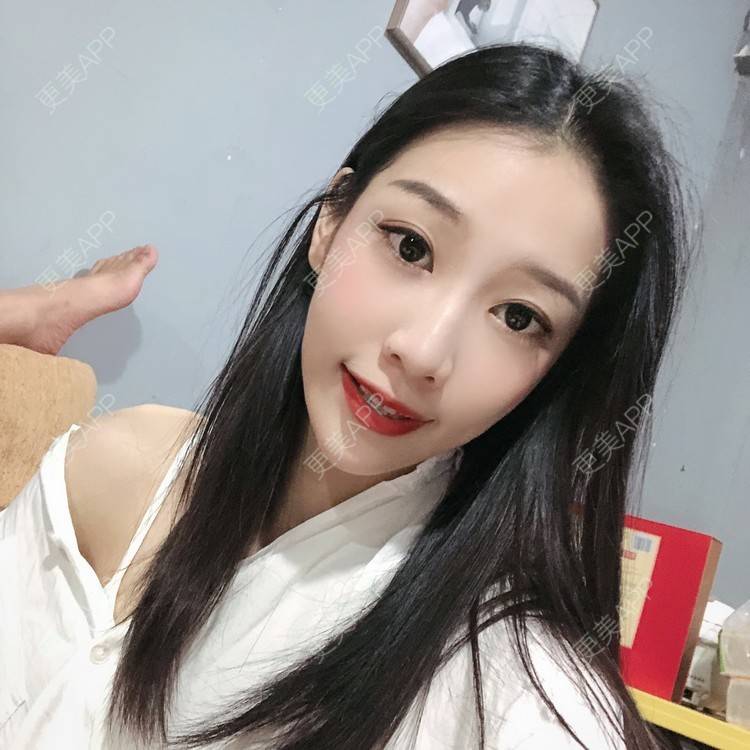 更美 - －Ｊane.’的牙齿矫正经验 | 牙齿矫正 | 广州