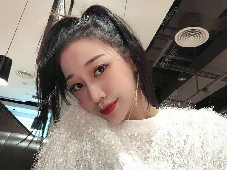 更美 - －Ｊane.’的牙齿矫正经验 | 牙齿矫正 | 广州