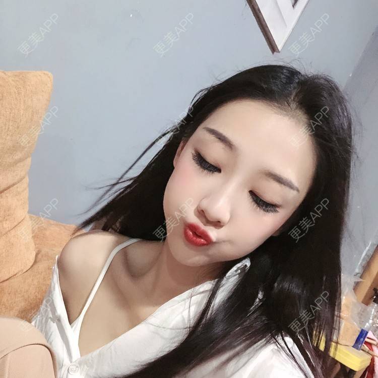 更美 - －Ｊane.’的牙齿矫正经验 | 牙齿矫正 | 广州