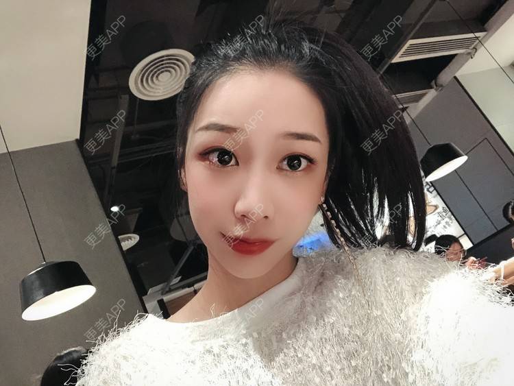 更美 - －Ｊane.’的牙齿矫正经验 | 牙齿矫正 | 广州