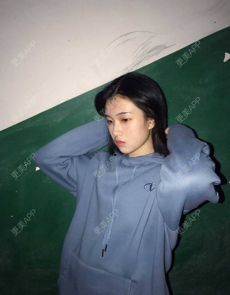 更美 - 罗兰儿的牙齿瓷贴面经验 | 成都 | 牙齿瓷贴面