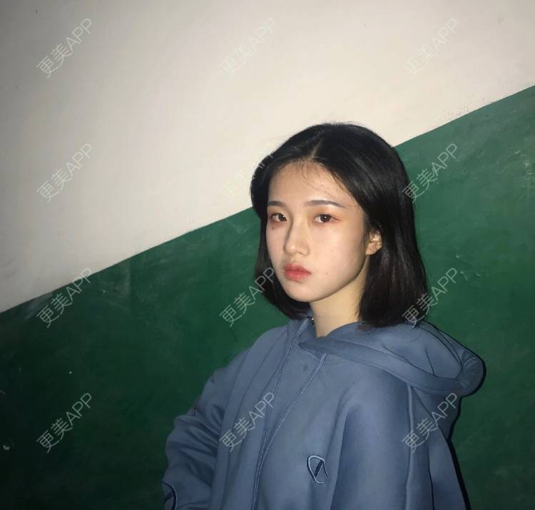 更美 - 罗兰儿的牙齿瓷贴面经验 | 成都 | 牙齿瓷贴面