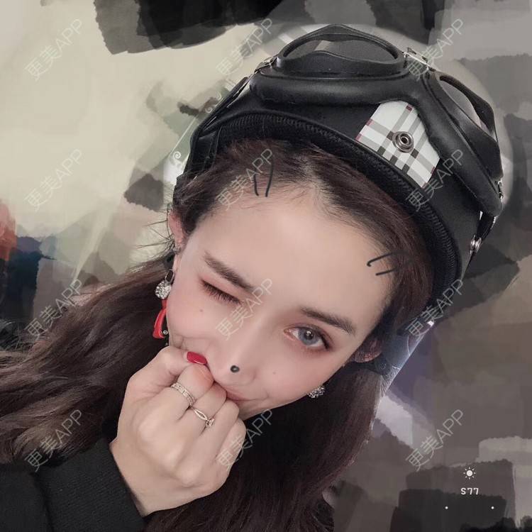 更美 - 丢了灵魂的孩纸的唇腭裂修复经验 | 厚唇改薄 | 唇腭裂修复 | 玻尿酸唇部 | 自体脂肪丰唇 | 胶原蛋白丰唇