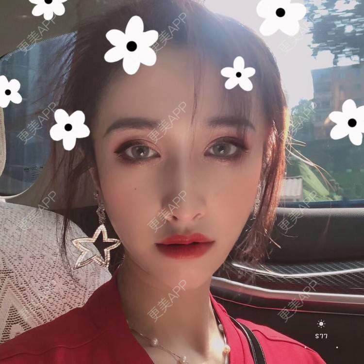 更美 - 丢了灵魂的孩纸的唇腭裂修复经验 | 厚唇改薄 | 唇腭裂修复 | 玻尿酸唇部 | 自体脂肪丰唇 | 胶原蛋白丰唇