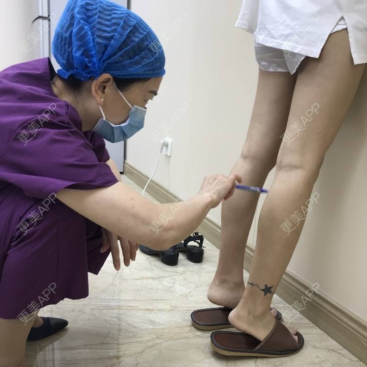 ogress乚的除皱瘦脸瘦腿日记