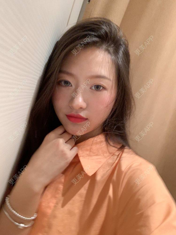更美 - 西西小妹子的经验 | 红蓝光清痘 | 广州 | 祛疤痕痘印 | 视频日记