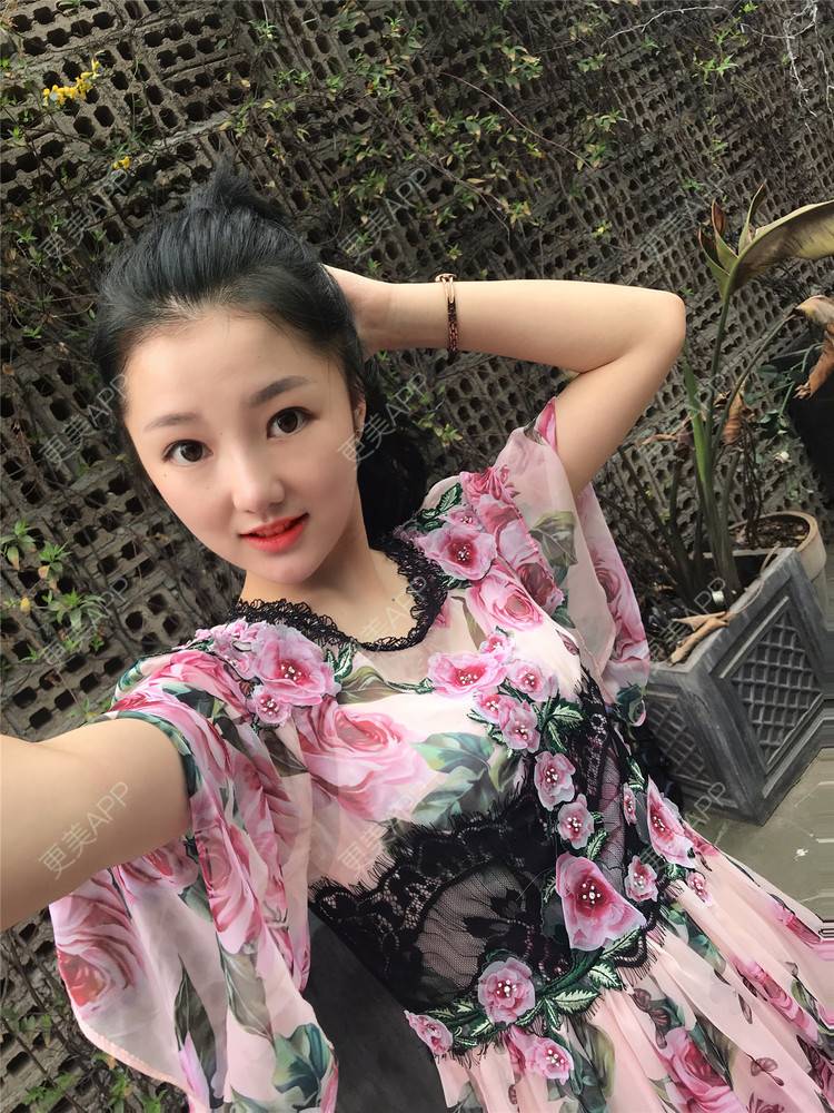 更美 - 攒一身可爱🍓的玻尿酸苹果肌经验 | 视频日记 | 玻尿酸苹果肌 | 杭州