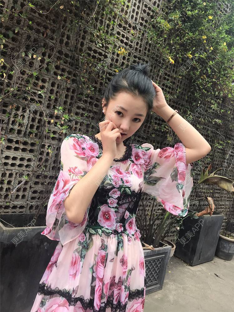 更美 - 攒一身可爱🍓的玻尿酸苹果肌经验 | 视频日记 | 玻尿酸苹果肌 | 杭州