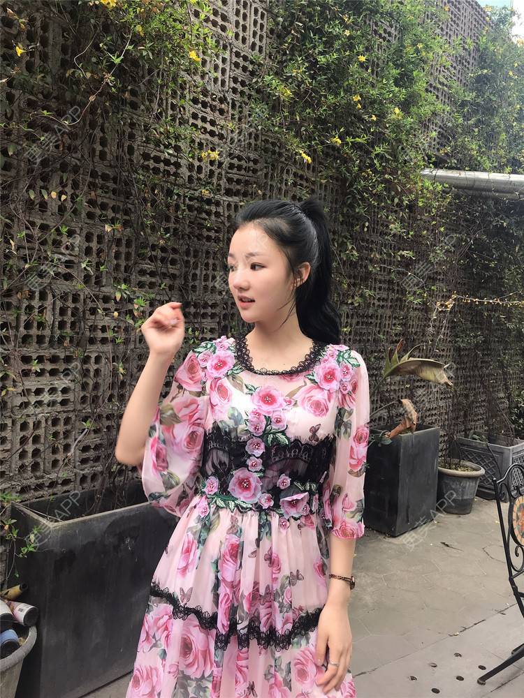 更美 - 攒一身可爱🍓的玻尿酸苹果肌经验 | 视频日记 | 玻尿酸苹果肌 | 杭州