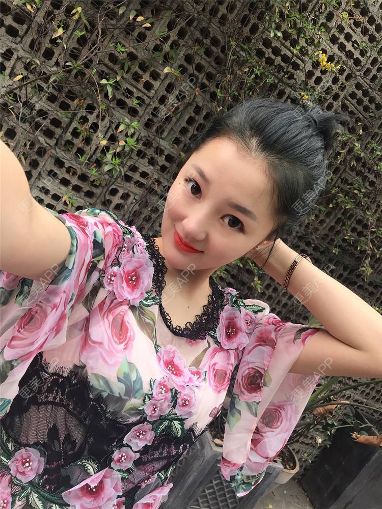 更美 - 攒一身可爱🍓的玻尿酸苹果肌经验 | 视频日记 | 玻尿酸苹果肌 | 杭州