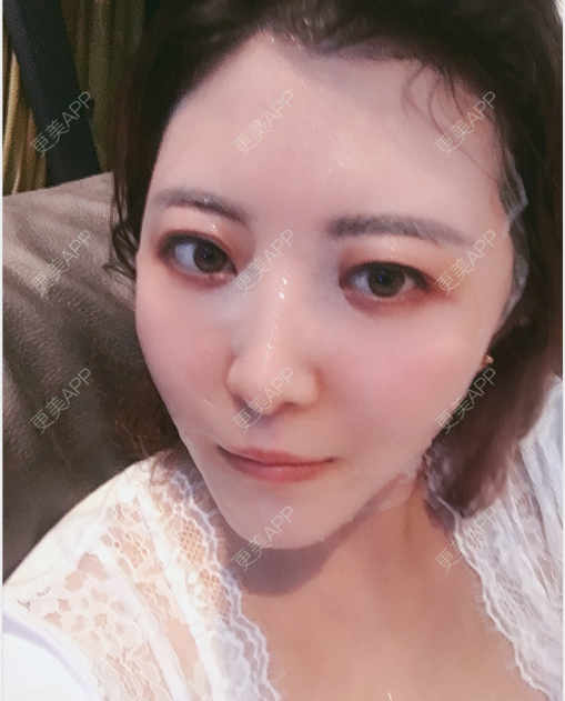 更美 - 更美用户4JgZgbP3JE的激光溶脂瘦脸经验 | 激光溶脂瘦脸 | 深圳