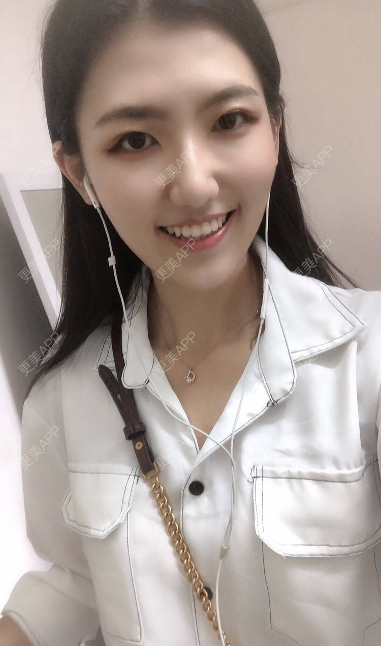 更美 - 下一站天亮的乳头内陷矫正经验 | 乳头内陷矫正 | 上海