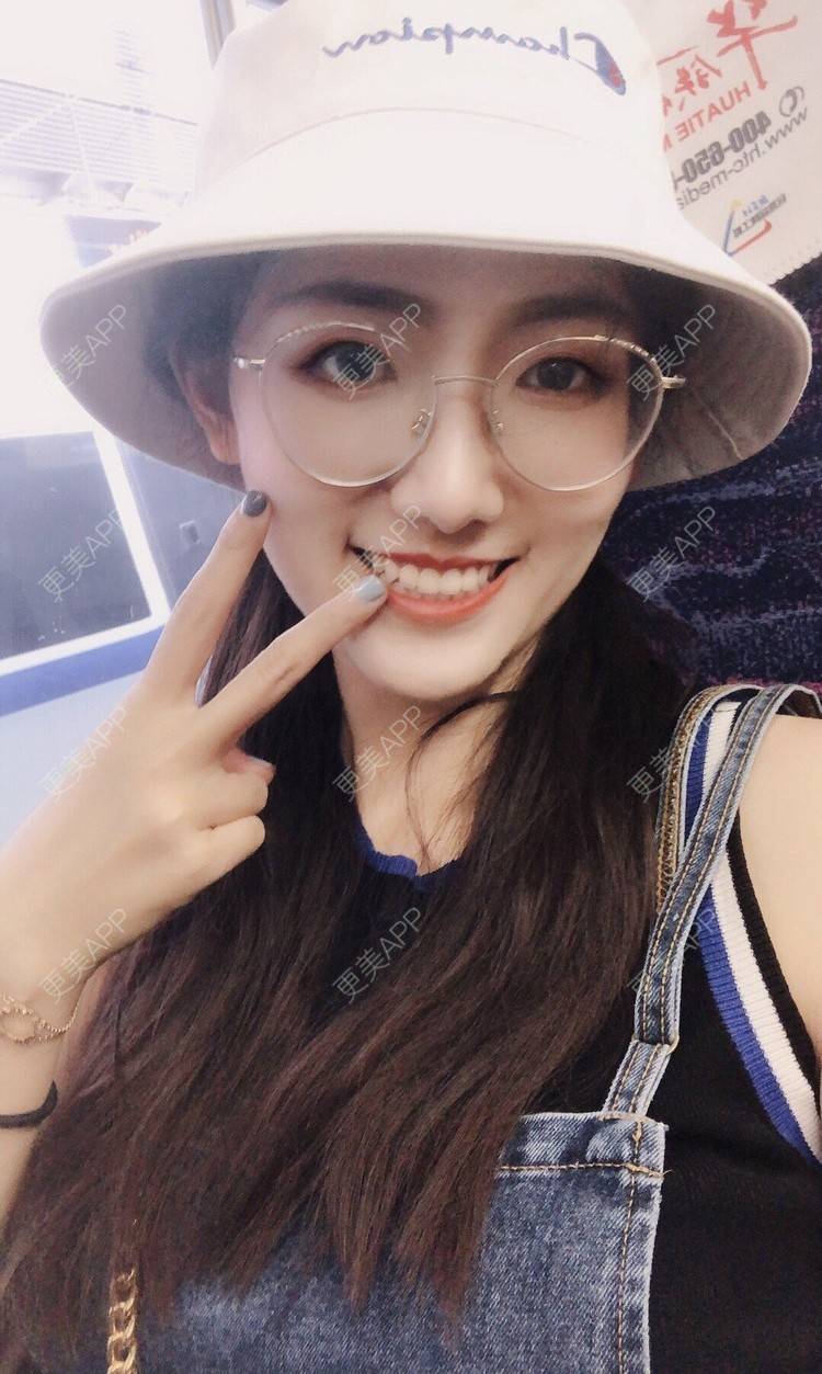 更美 - 下一站天亮的乳头内陷矫正经验 | 乳头内陷矫正 | 上海