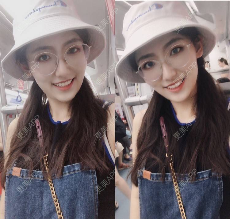 更美 - 下一站天亮的乳头内陷矫正经验 | 乳头内陷矫正 | 上海
