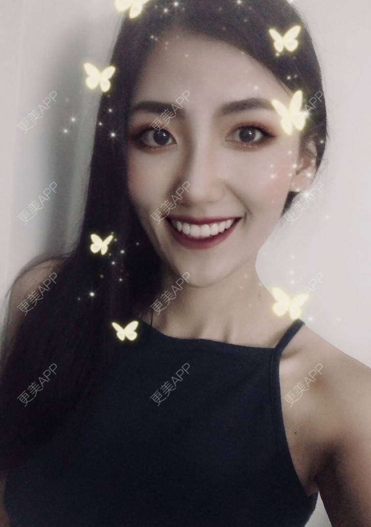 更美 - 下一站天亮的乳头内陷矫正经验 | 乳头内陷矫正 | 上海