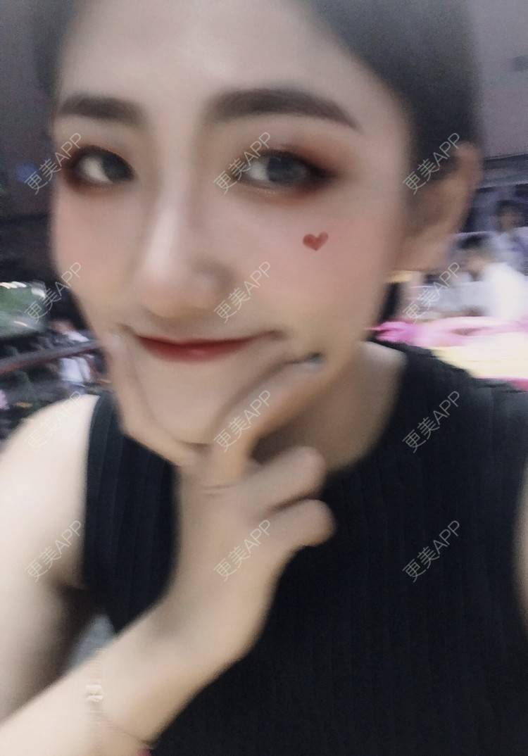 更美 - 下一站天亮的乳头内陷矫正经验 | 乳头内陷矫正 | 上海