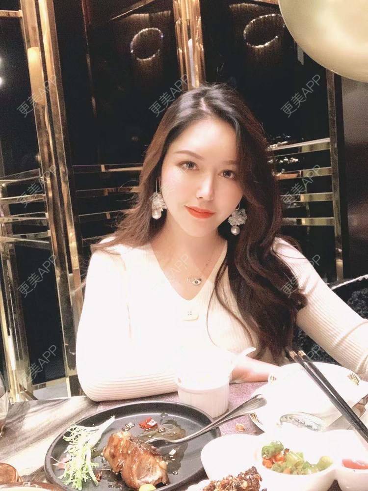 更美 - 更美用户dapPewZ45A的自体脂肪丰额头经验 | 自体脂肪丰额头 | 重庆