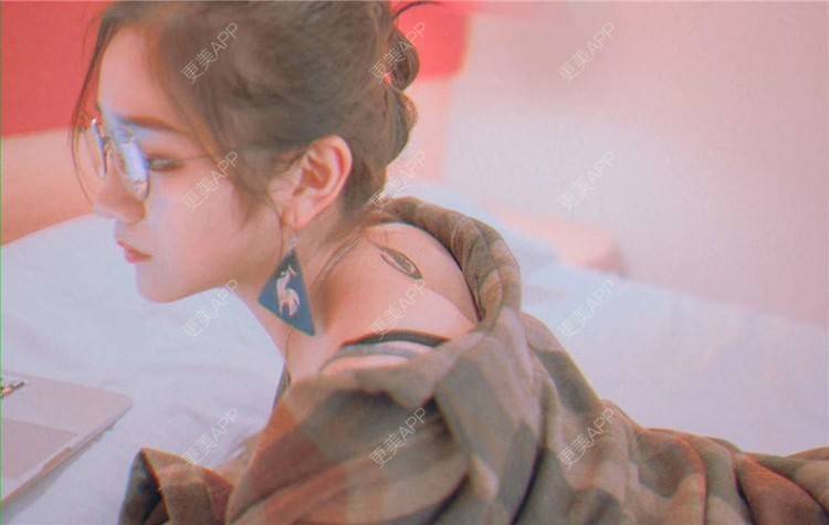 更美 - 宣呀的自体脂肪丰苹果肌经验 | 自体脂肪面部填充 | 自体脂肪全面部填充 | 自体脂肪丰面颊 | 武汉