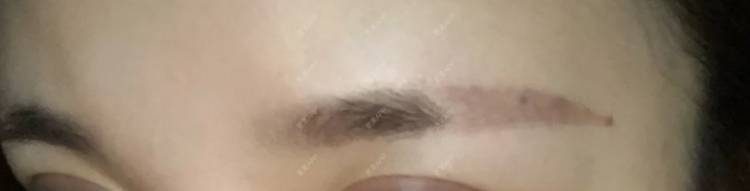 更美 - 单挑大龙的软妹撼的激光洗眉经验 | 激光洗眉 | 广州