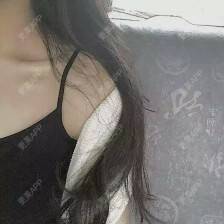 更美 - 若没有回忆查了的手术去副乳经验 | 手术去副乳 | 上海
