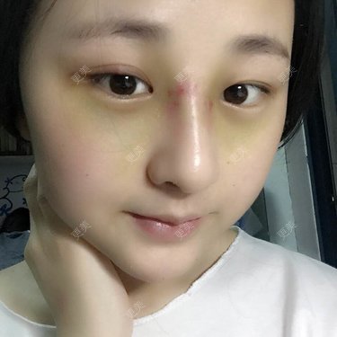 怎么能没有炸鸡和啤酒