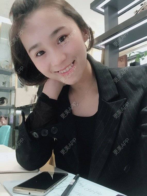 更美 - 宝儿姐😄的全瓷牙经验 | 全瓷牙 | 合金烤瓷牙 | 二氧化锆烤瓷牙