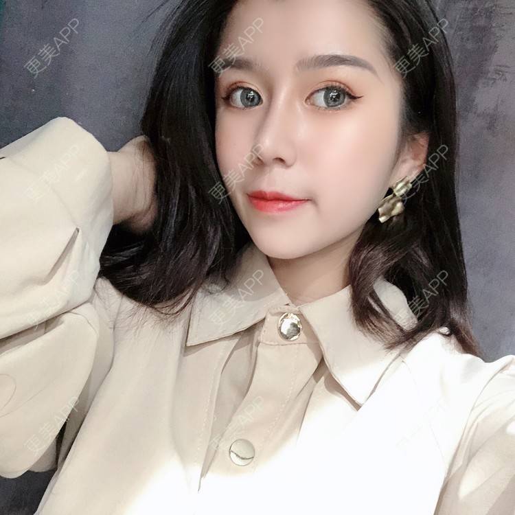 更美 - 更美用户9yYXeaKYPH的鼻部多项经验 | 鼻部多项 | 鼻中隔软骨垫鼻头 | 自体软骨垫鼻尖 | 鼻小柱缩短 | 肋软骨隆鼻