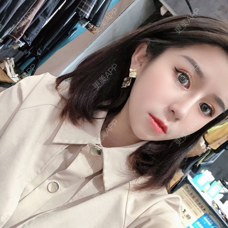 更美 - 更美用户9yYXeaKYPH的鼻部多项经验 | 鼻部多项 | 鼻中隔软骨垫鼻头 | 自体软骨垫鼻尖 | 鼻小柱缩短 | 肋软骨隆鼻