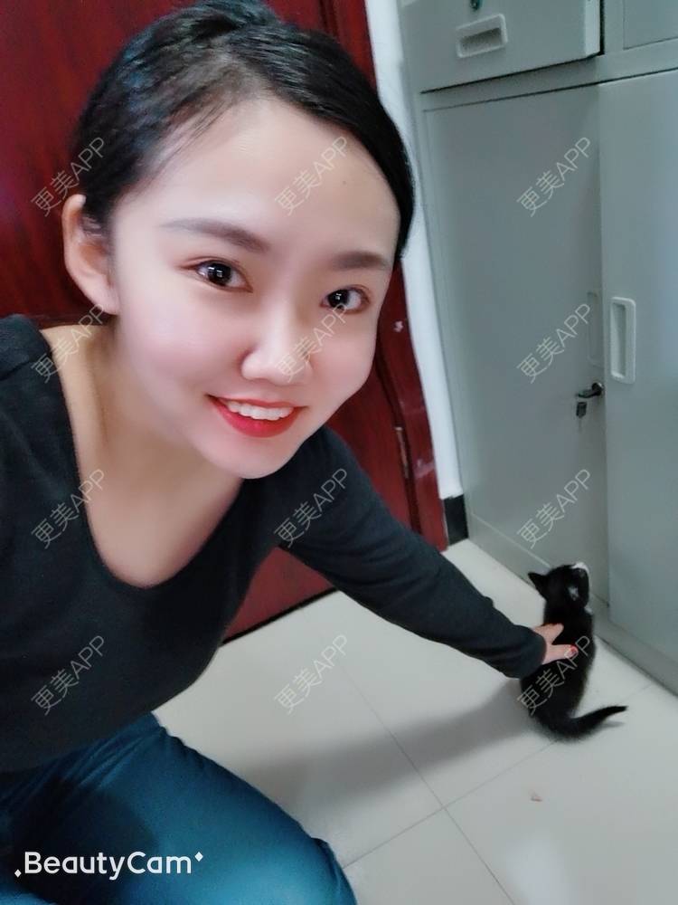 更美 - 萌萌哒淡墨的经验 | 腰腹吸脂 | 背部吸脂 | 自体脂肪丰臀 | 手臂吸脂 | 成都 | 视频日记
