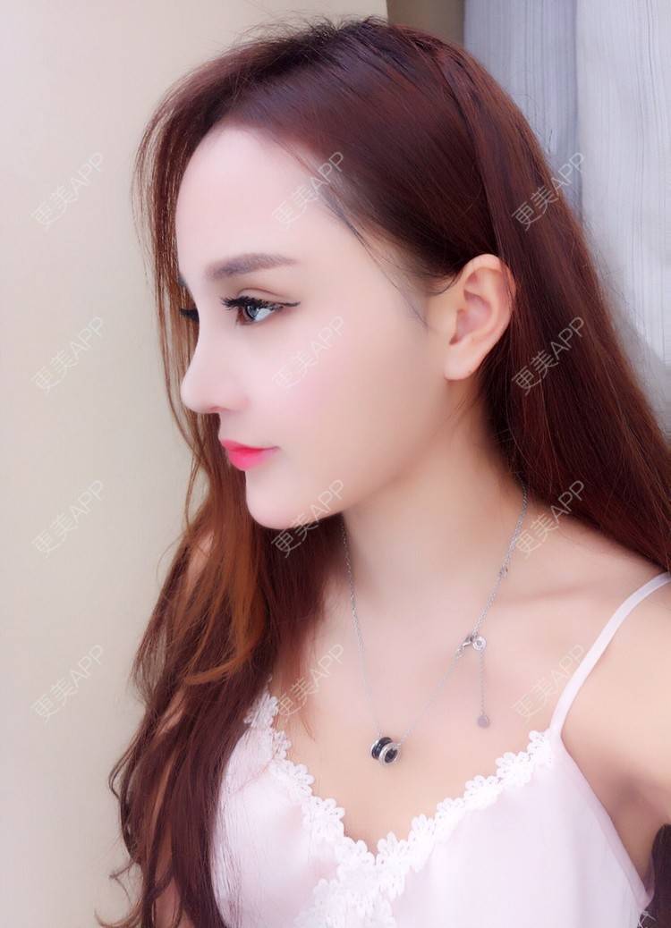 青春易逝先的鼻综合日记