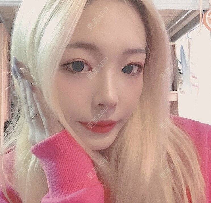 更美 - 冷语热心人的手术去副乳经验 | 手术去副乳 | 上海