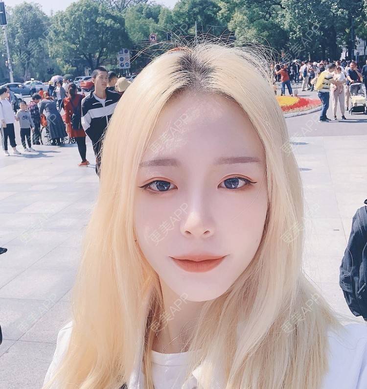 更美 - 冷语热心人的手术去副乳经验 | 手术去副乳 | 上海